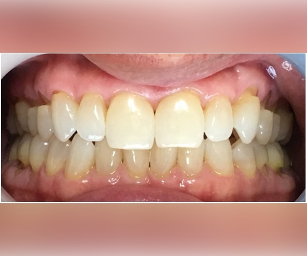 before-and-after-dentist
